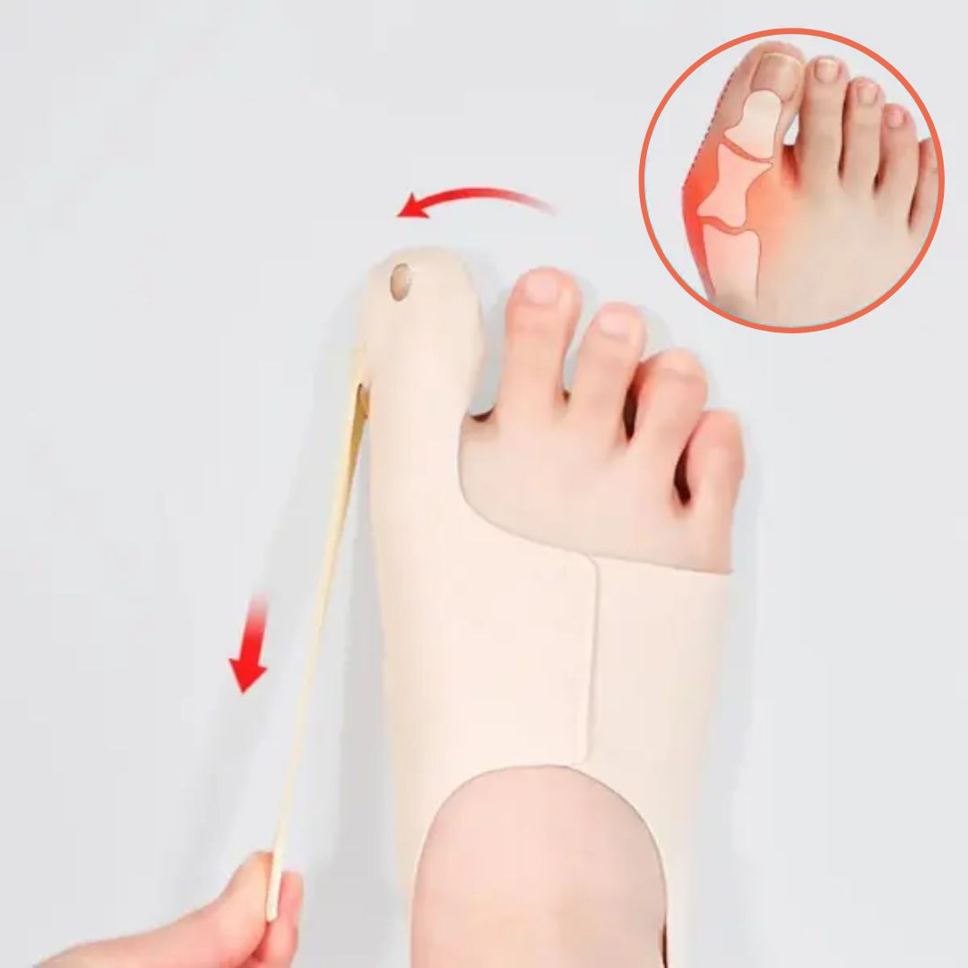 Corrector de Juanetes para Movimiento sin Dolor