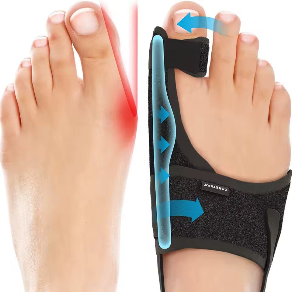 Férula Nocturna para Hallux Valgus - Confort Ergonómico y Ajustable