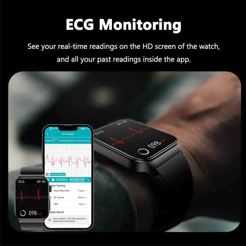 Reloj inteligente todo en uno para monitorización de salud con ECG y medidor de glucosa en sangre