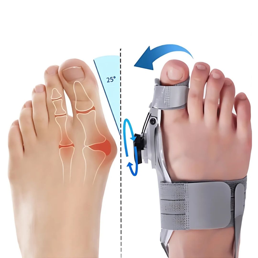 Soportes de Alivio Ajustables | Corrector de Hallux Valgus